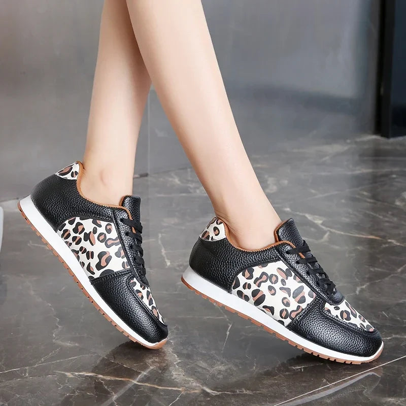 Keira™ | Lujo casual con alma urbana